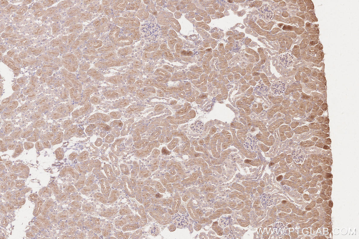 Immunohistochemical analysis of paraffin-embedded mouse kidney tissue slide using KHC2566 (RNF123 IHC Kit).