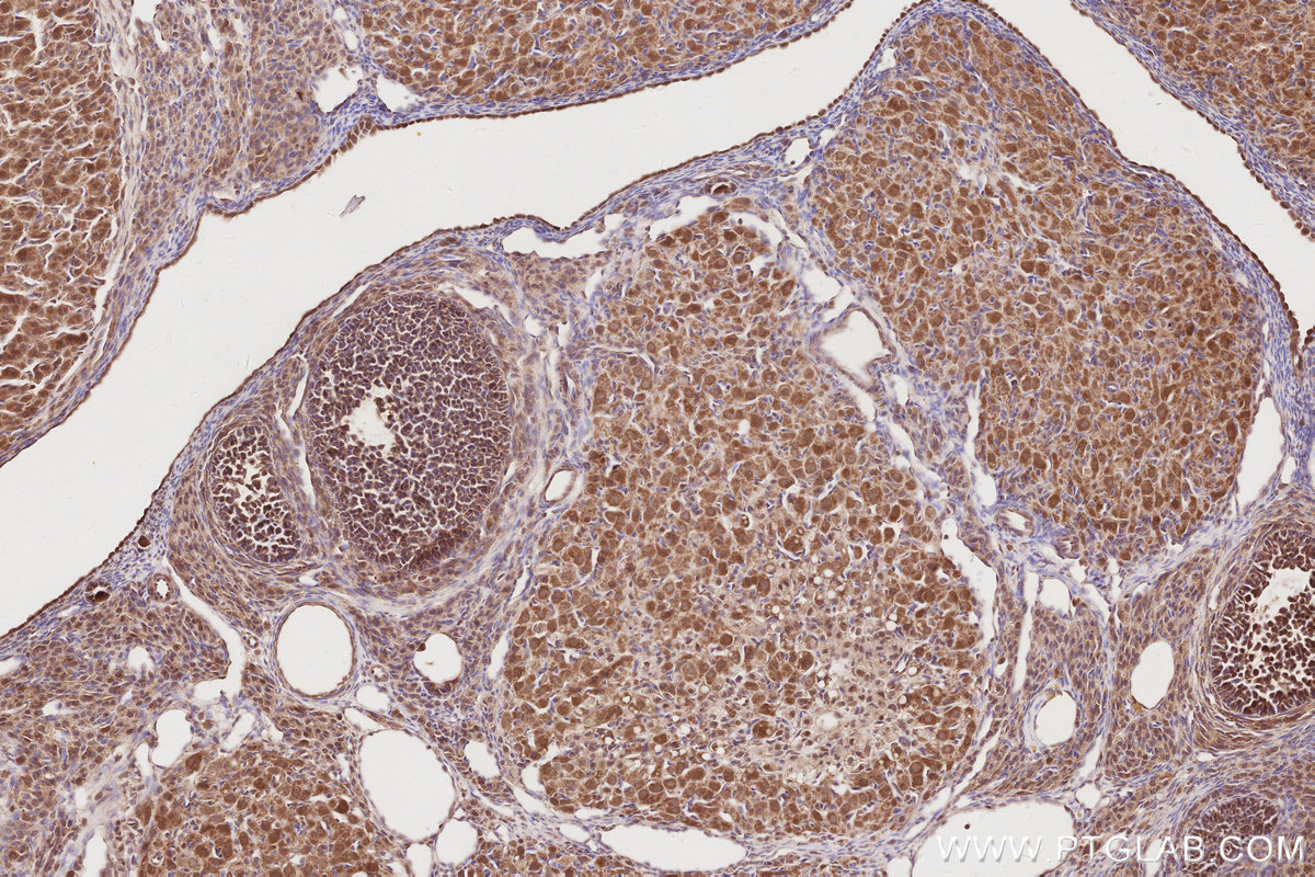 Immunohistochemical analysis of paraffin-embedded rat ovary tissue slide using KHC2871 (RNF126 IHC Kit).