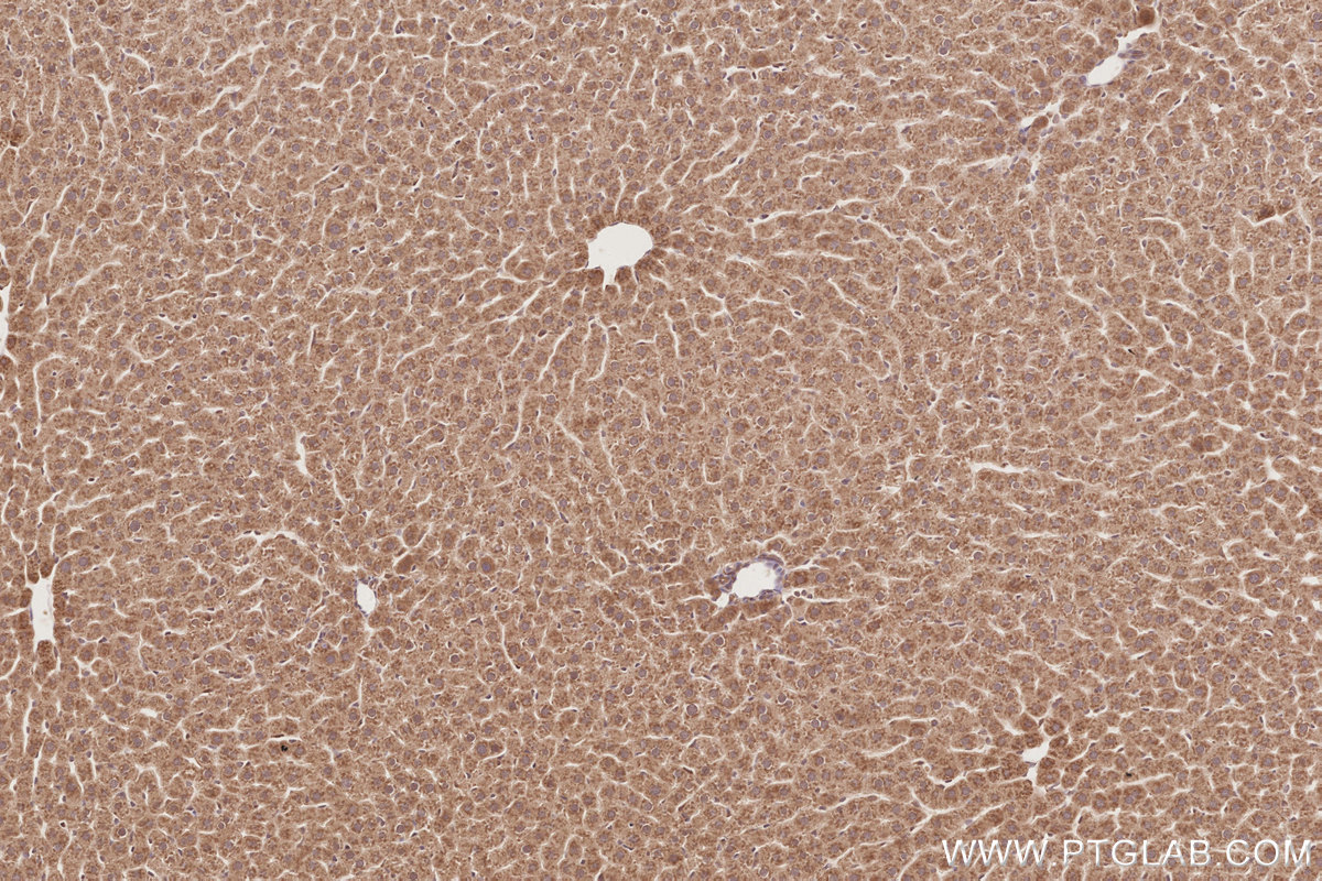 Immunohistochemical analysis of paraffin-embedded rat liver tissue slide using KHC2871 (RNF126 IHC Kit).