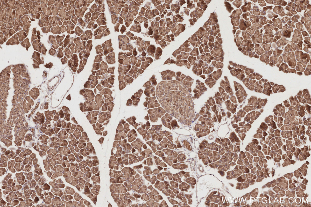 Immunohistochemical analysis of paraffin-embedded mouse pancreas tissue slide using KHC2871 (RNF126 IHC Kit).