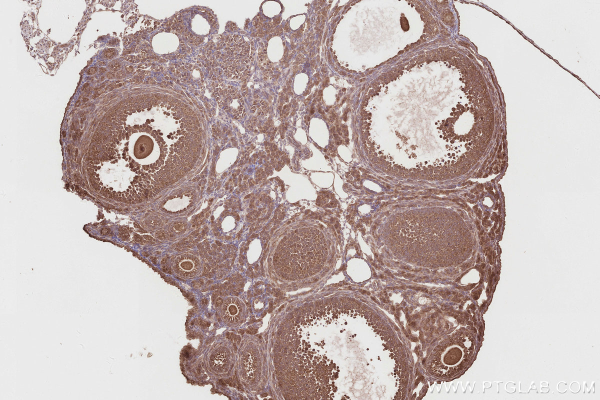 Immunohistochemical analysis of paraffin-embedded mouse ovary tissue slide using KHC2871 (RNF126 IHC Kit).