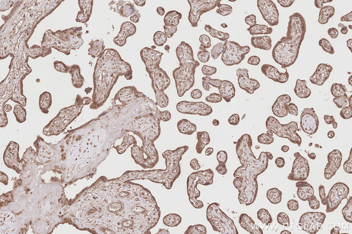 Immunohistochemical analysis of paraffin-embedded human placenta tissue slide using KHC2871 (RNF126 IHC Kit).
