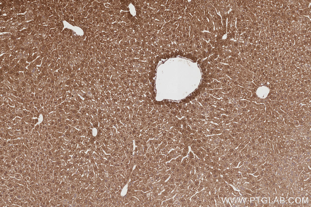 Immunohistochemical analysis of paraffin-embedded mouse liver tissue slide using KHC2871 (RNF126 IHC Kit).