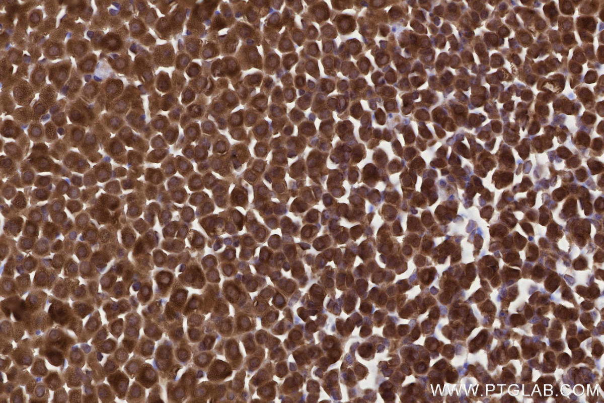 Immunohistochemical analysis of paraffin-embedded mouse adrenal gland tissue slide using KHC2730 (RNF139 IHC Kit).