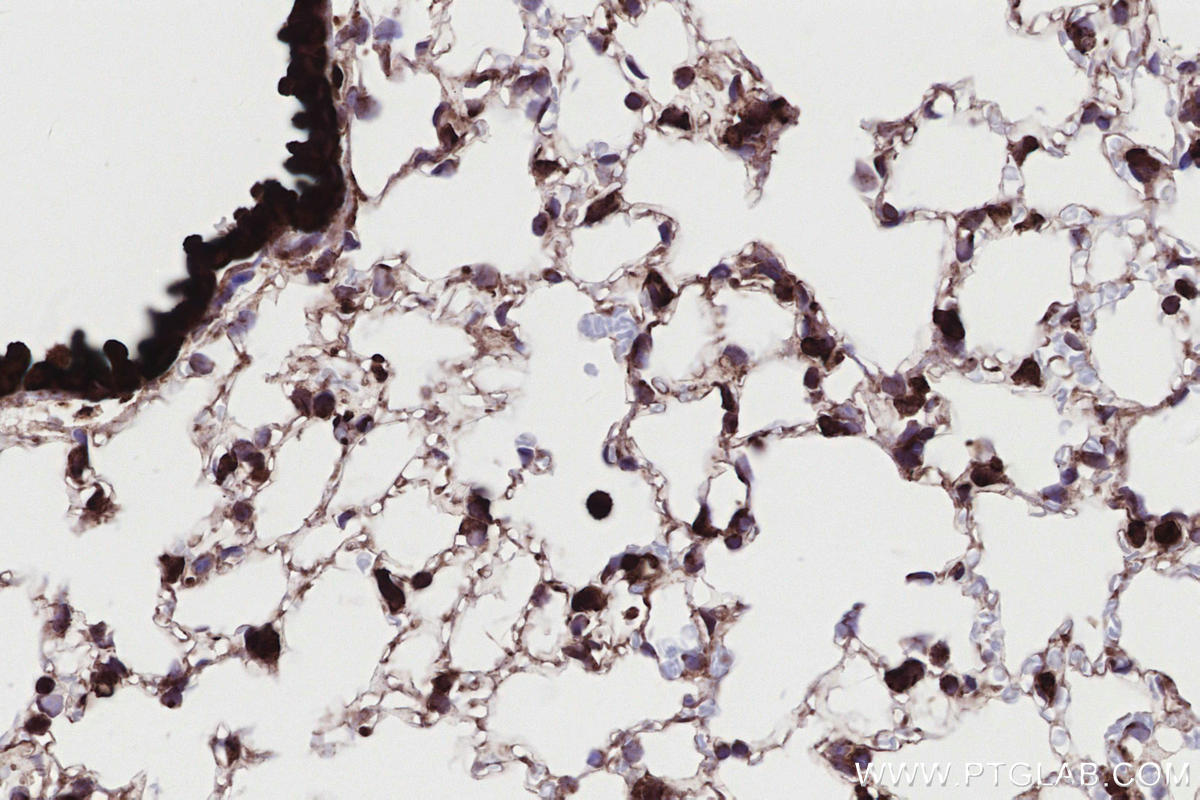 Immunohistochemical analysis of paraffin-embedded mouse lung tissue slide using KHC2730 (RNF139 IHC Kit).