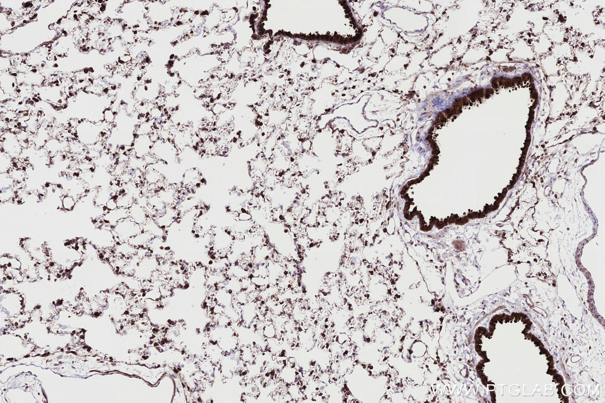 Immunohistochemical analysis of paraffin-embedded rat lung tissue slide using KHC2730 (RNF139 IHC Kit).