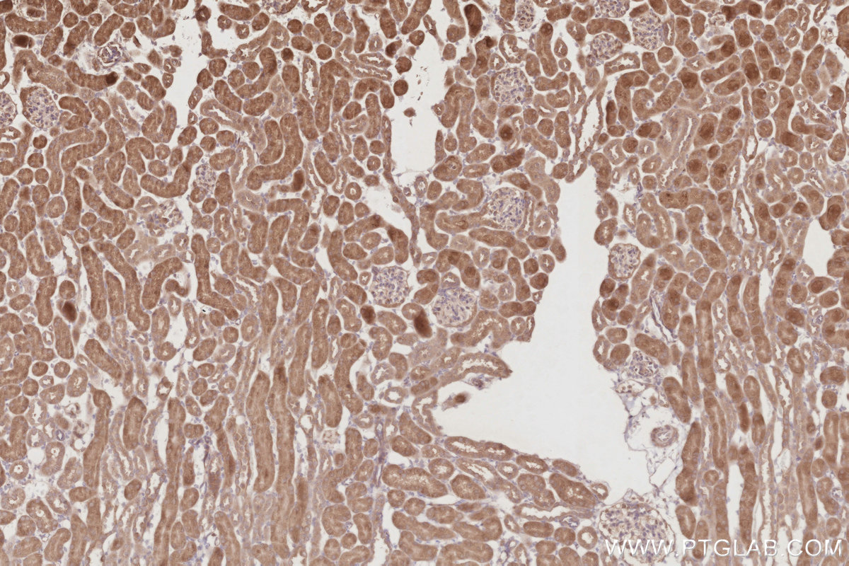 Immunohistochemical analysis of paraffin-embedded mouse kidney tissue slide using KHC2923 (RNF167 IHC Kit).