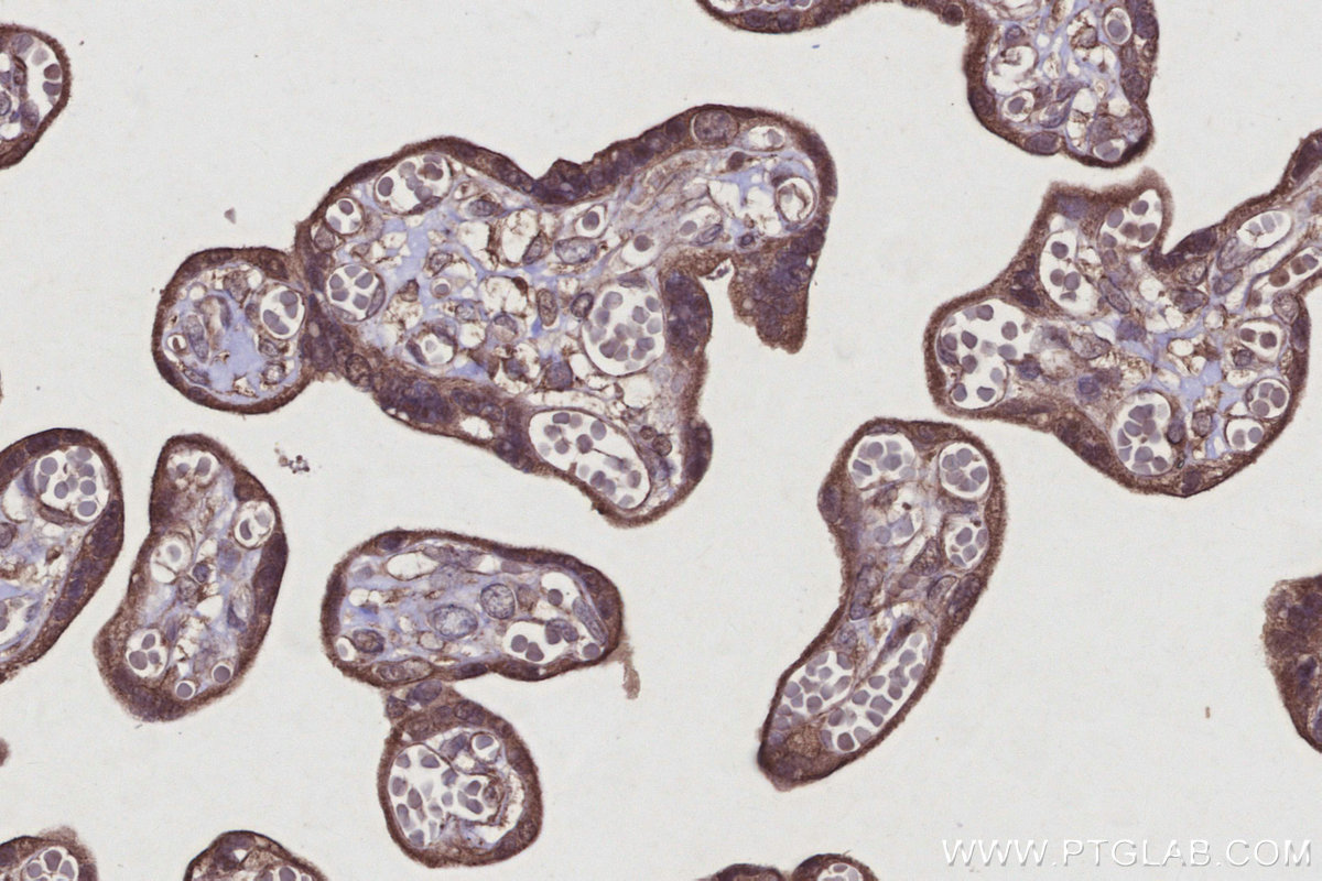 Immunohistochemical analysis of paraffin-embedded human placenta tissue slide using KHC2923 (RNF167 IHC Kit).