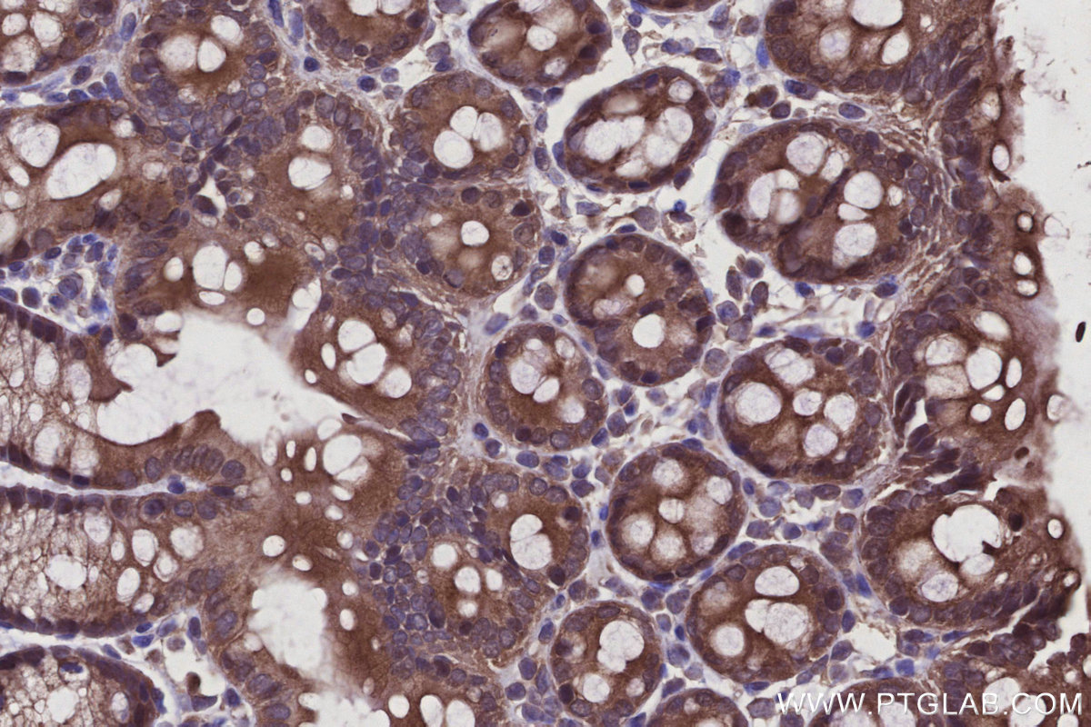 Immunohistochemical analysis of paraffin-embedded mouse colon tissue slide using KHC2923 (RNF167 IHC Kit).
