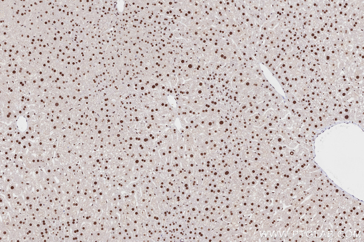 Immunohistochemical analysis of paraffin-embedded mouse liver tissue slide using KHC2840 (RNF2 IHC Kit).
