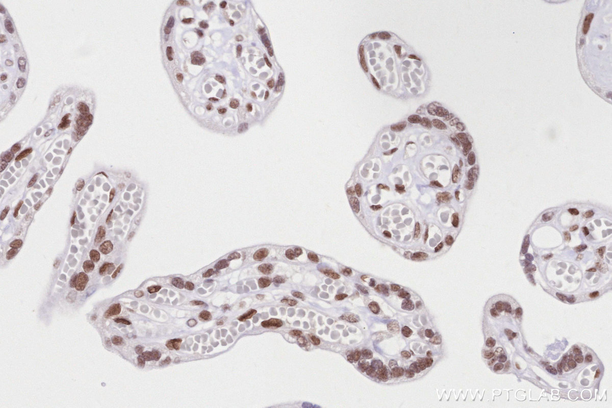 Immunohistochemical analysis of paraffin-embedded human placenta tissue slide using KHC2840 (RNF2 IHC Kit).