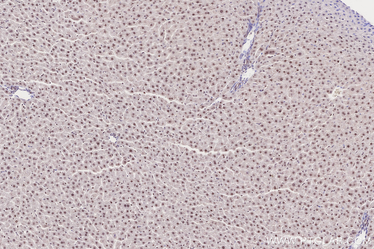 Immunohistochemical analysis of paraffin-embedded rat liver tissue slide using KHC2840 (RNF2 IHC Kit).