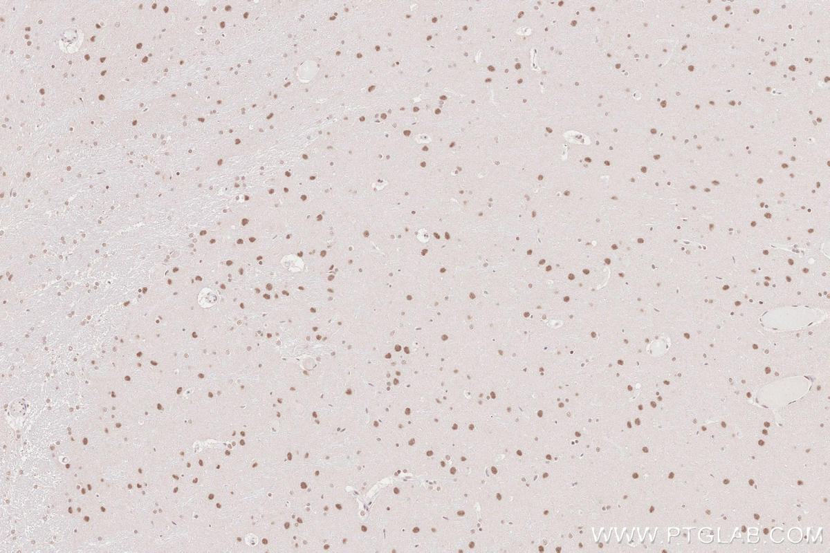 Immunohistochemical analysis of paraffin-embedded rat brain tissue slide using KHC2563 (RNF20 IHC Kit).