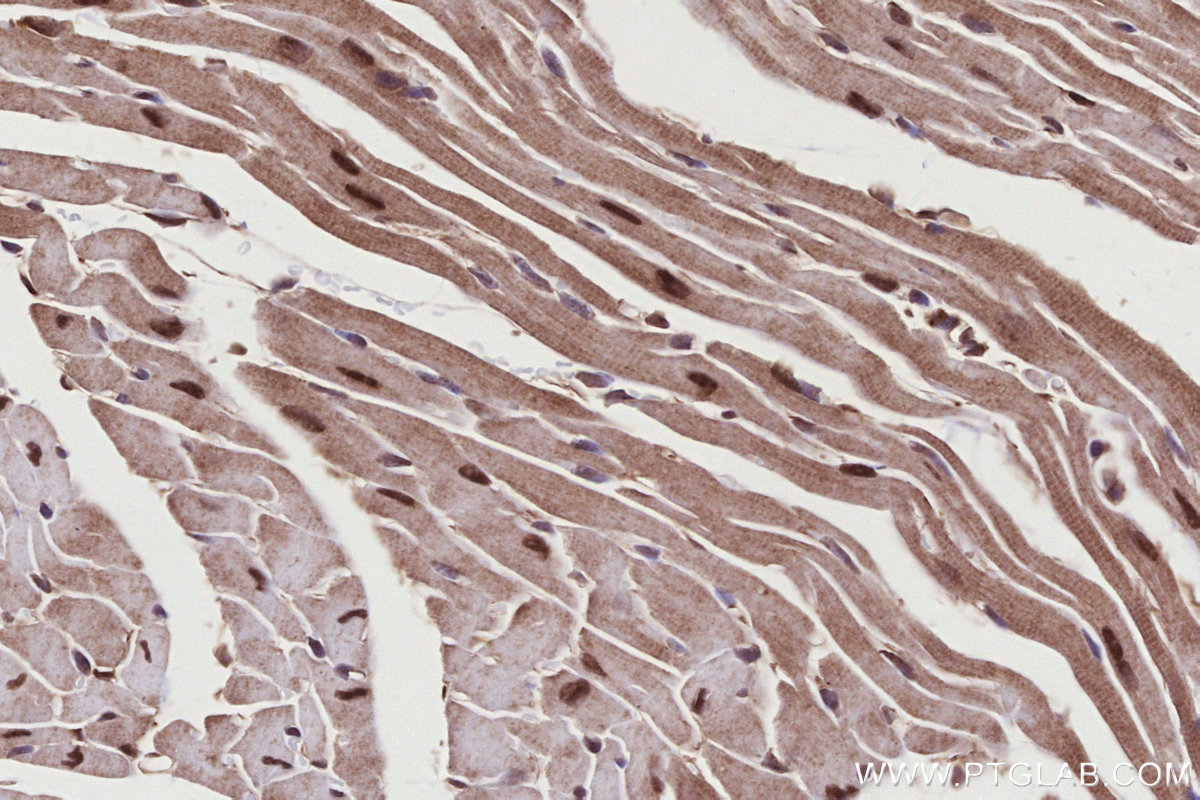 Immunohistochemical analysis of paraffin-embedded mouse heart tissue slide using KHC2773 (RNF34 IHC Kit).