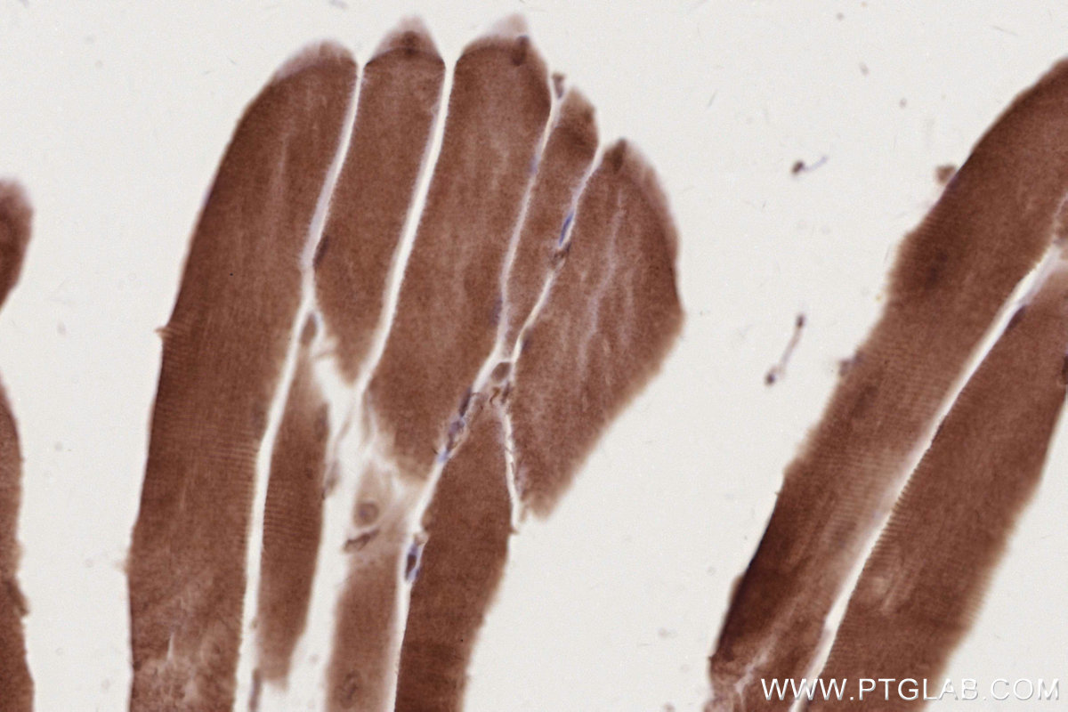 Immunohistochemical analysis of paraffin-embedded mouse skeletal muscle tissue slide using KHC2773 (RNF34 IHC Kit).