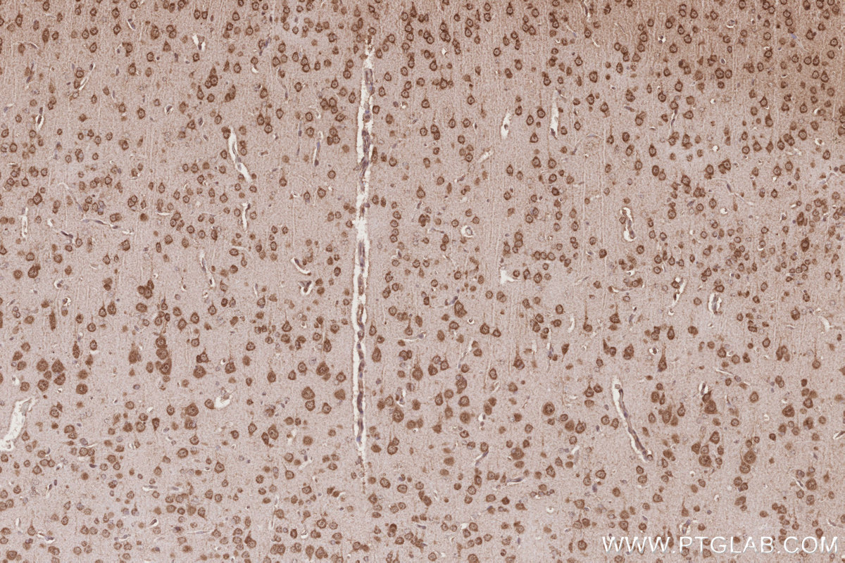 Immunohistochemical analysis of paraffin-embedded rat brain tissue slide using KHC2773 (RNF34 IHC Kit).