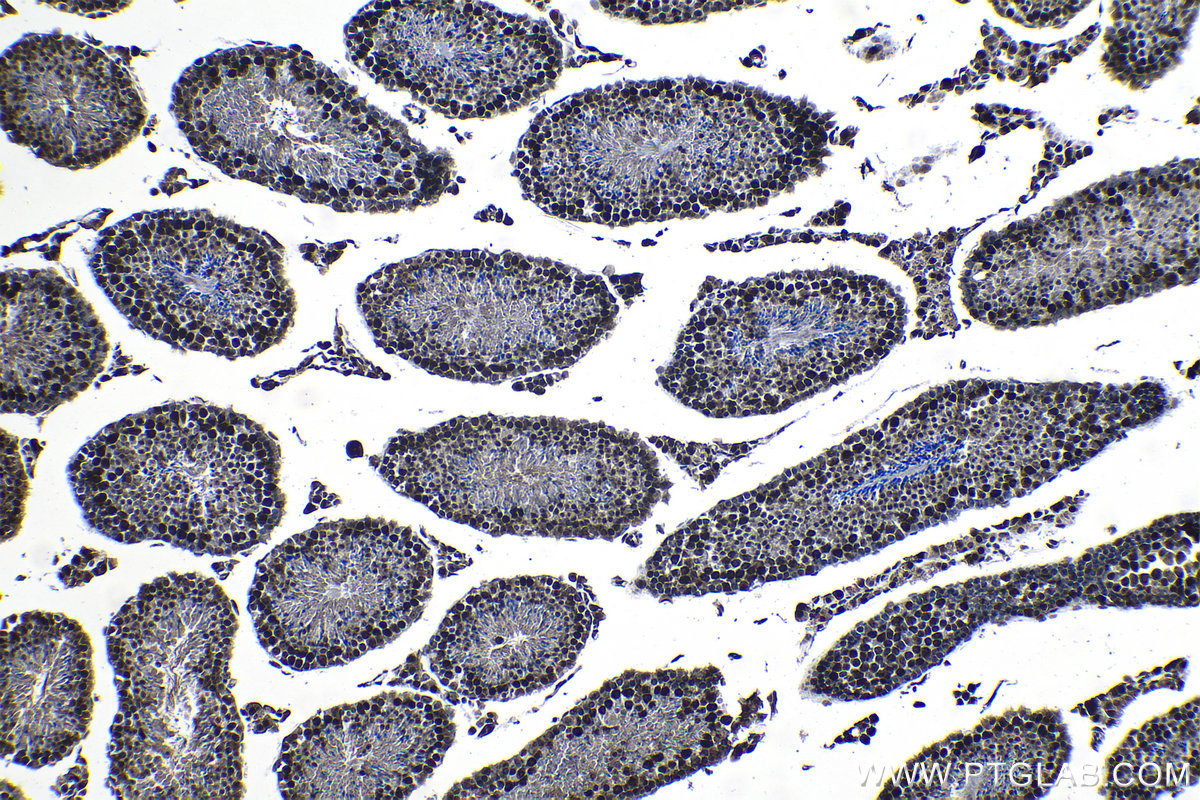 Immunohistochemical analysis of paraffin-embedded mouse testis tissue slide using KHC1243 (RNF6 IHC Kit).
