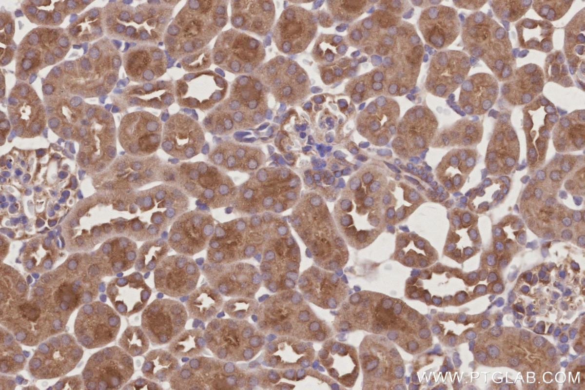 Immunohistochemical analysis of paraffin-embedded mouse kidney tissue slide using KHC2998 (RNF7 IHC Kit). Immunohistochemical analysis of paraffin-embedded mouse kidney tissue slide using KHC2998 (RNF7 IHC Kit).