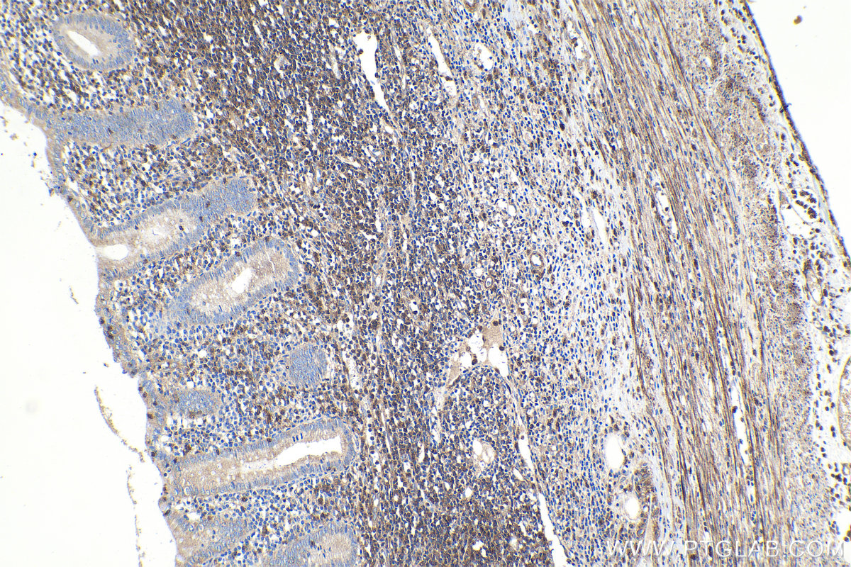 Immunohistochemical analysis of paraffin-embedded human appendicitis tissue slide using KHC1917 (ROGDI IHC Kit).