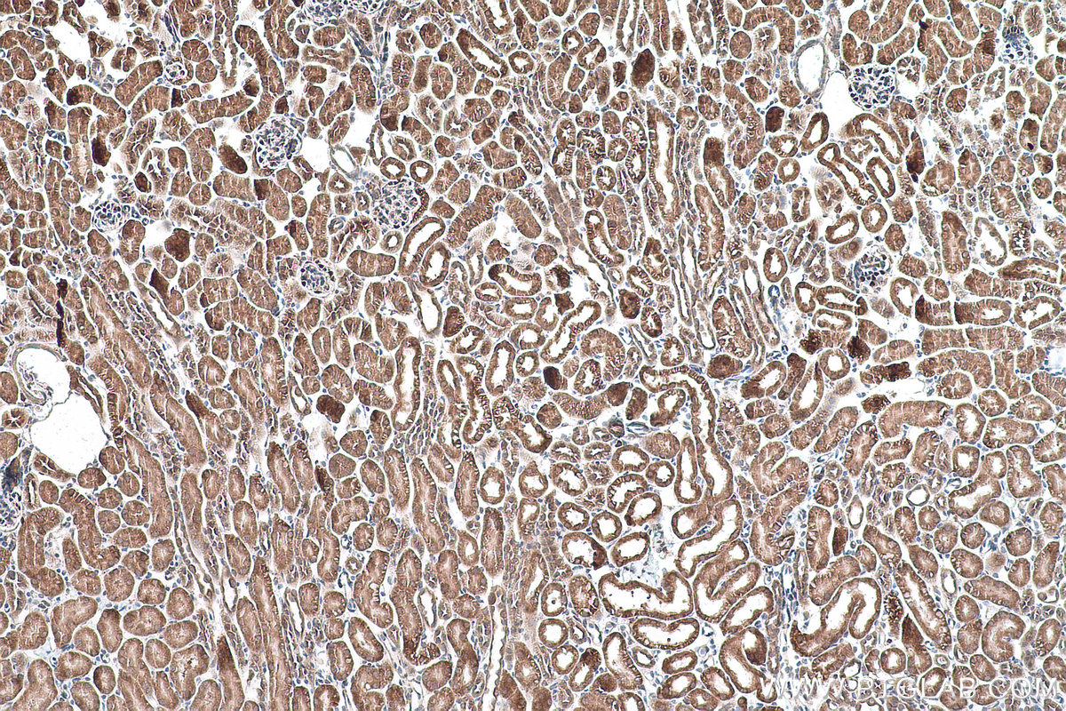 Immunohistochemical analysis of paraffin-embedded mouse kidney tissue slide using KHC0900 (RPL13 IHC Kit).