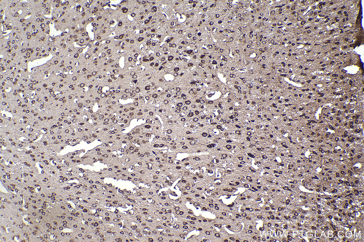 Immunohistochemical analysis of paraffin-embedded mouse brain tissue slide using KHC2374 (RPL19 IHC Kit).