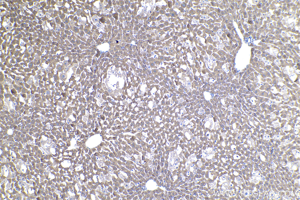 Immunohistochemical analysis of paraffin-embedded mouse liver tissue slide using KHC0914 (RPL21 IHC Kit).