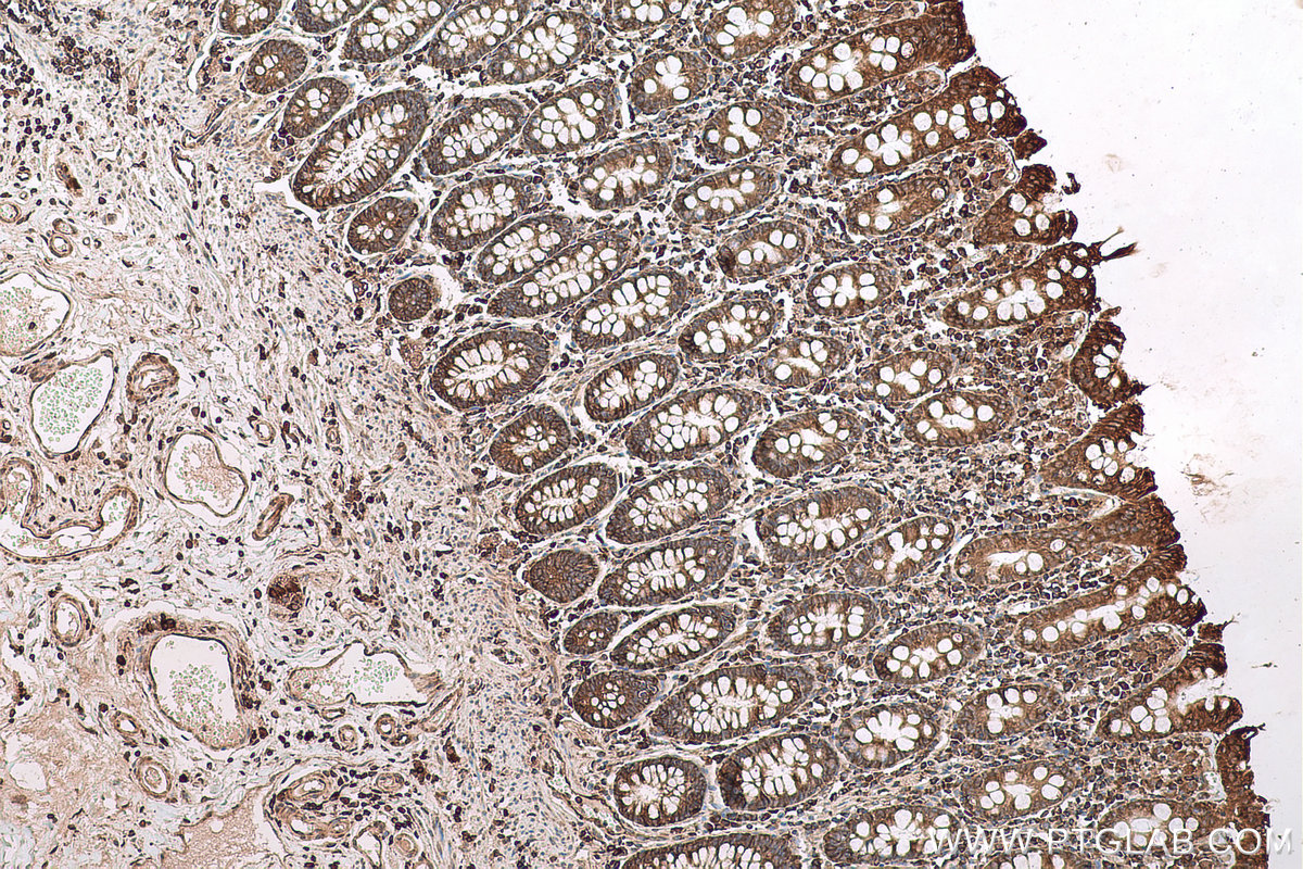 Immunohistochemical analysis of paraffin-embedded human colon tissue slide using KHC0639 (RPL23 IHC Kit).