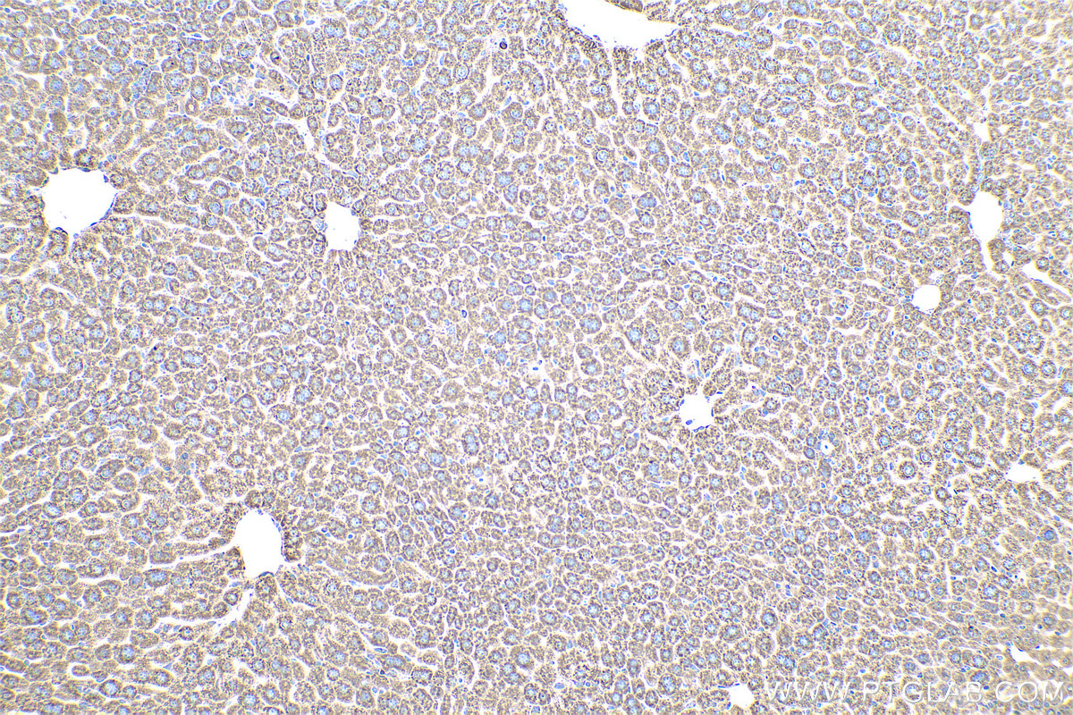 Immunohistochemical analysis of paraffin-embedded mouse liver tissue slide using KHC0583 (RPL23A IHC Kit).