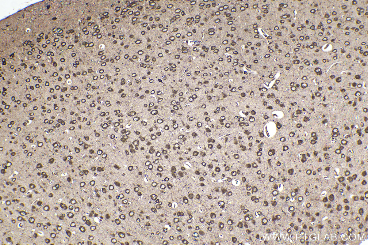 Immunohistochemical analysis of paraffin-embedded mouse brain tissue slide using KHC2253 (RPL4 IHC Kit).