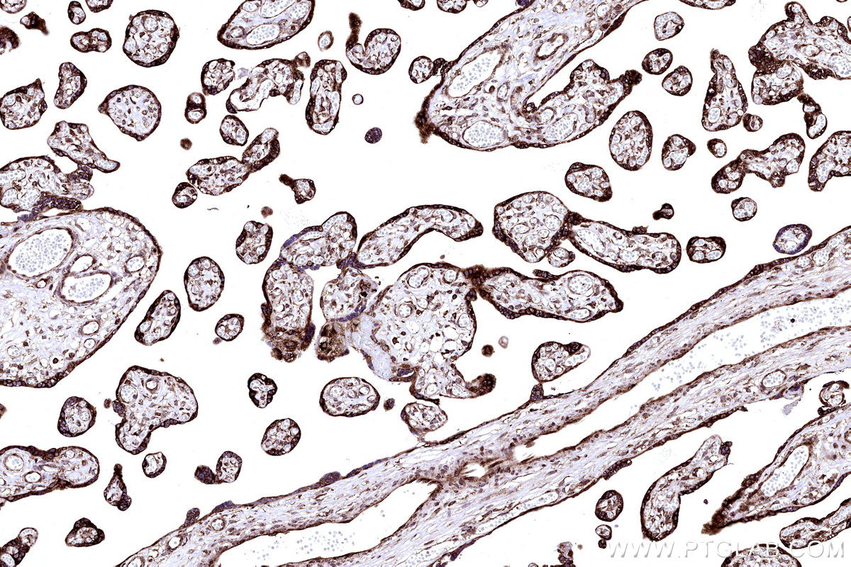 Immunohistochemical analysis of paraffin-embedded human placenta tissue slide using KHC3212 (RPL5 IHC Kit).