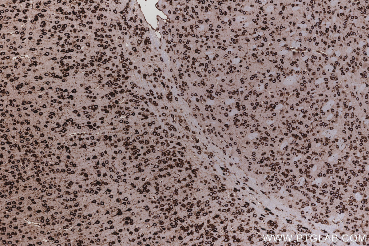 Immunohistochemical analysis of paraffin-embedded mouse brain tissue slide using KHC3212 (RPL5 IHC Kit).