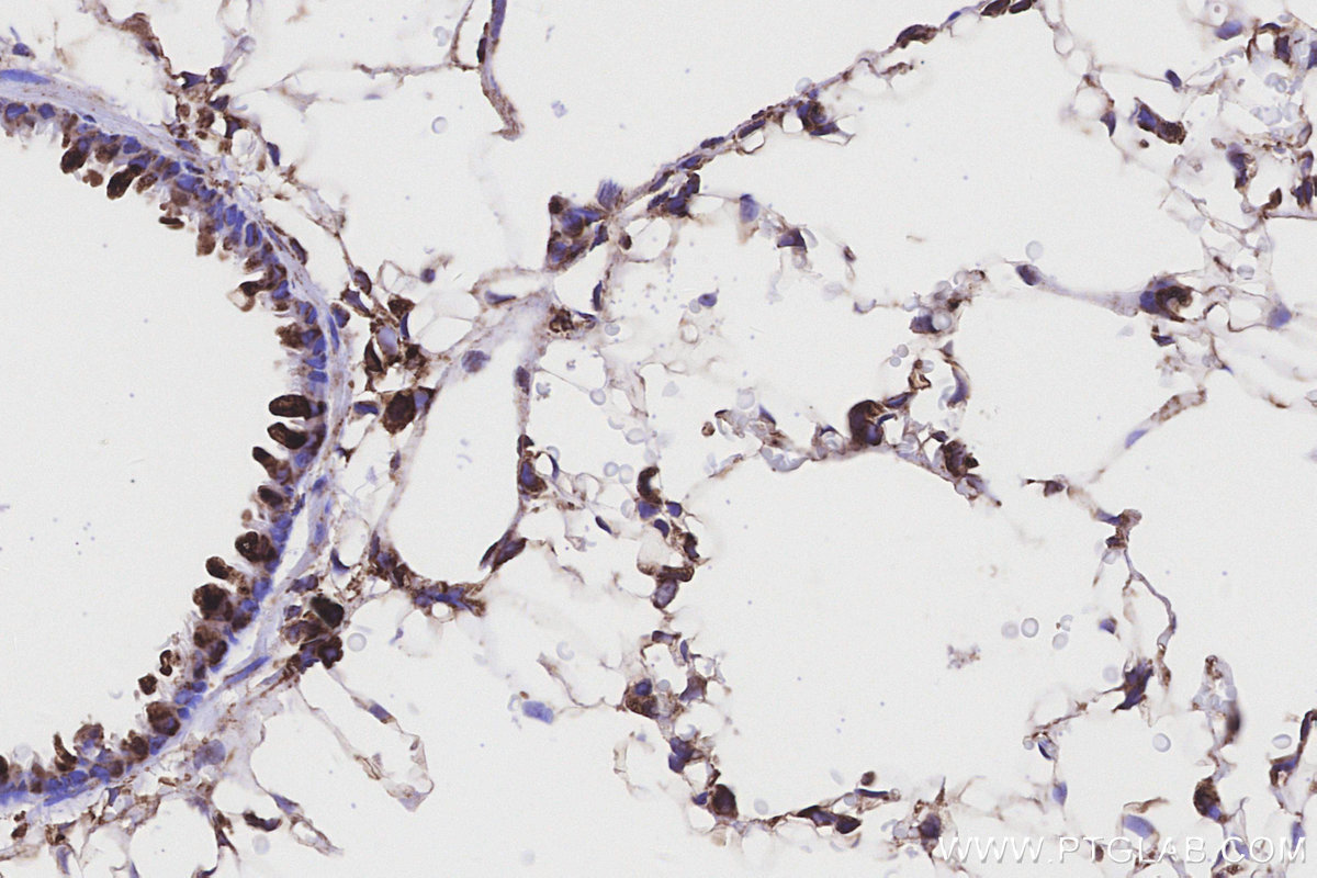 Immunohistochemical analysis of paraffin-embedded rat lung tissue slide using KHC3212 (RPL5 IHC Kit).
