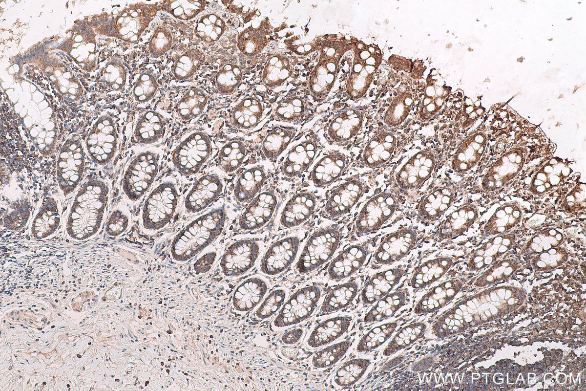 Immunohistochemical analysis of paraffin-embedded human colon tissue slide using KHC0640 (RPL6 IHC Kit).