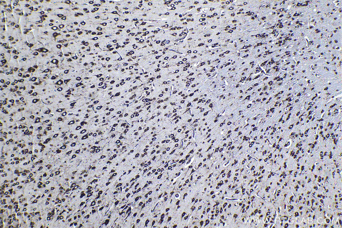 Immunohistochemical analysis of paraffin-embedded rat brain tissue slide using KHC1265 (RPL7A IHC Kit).