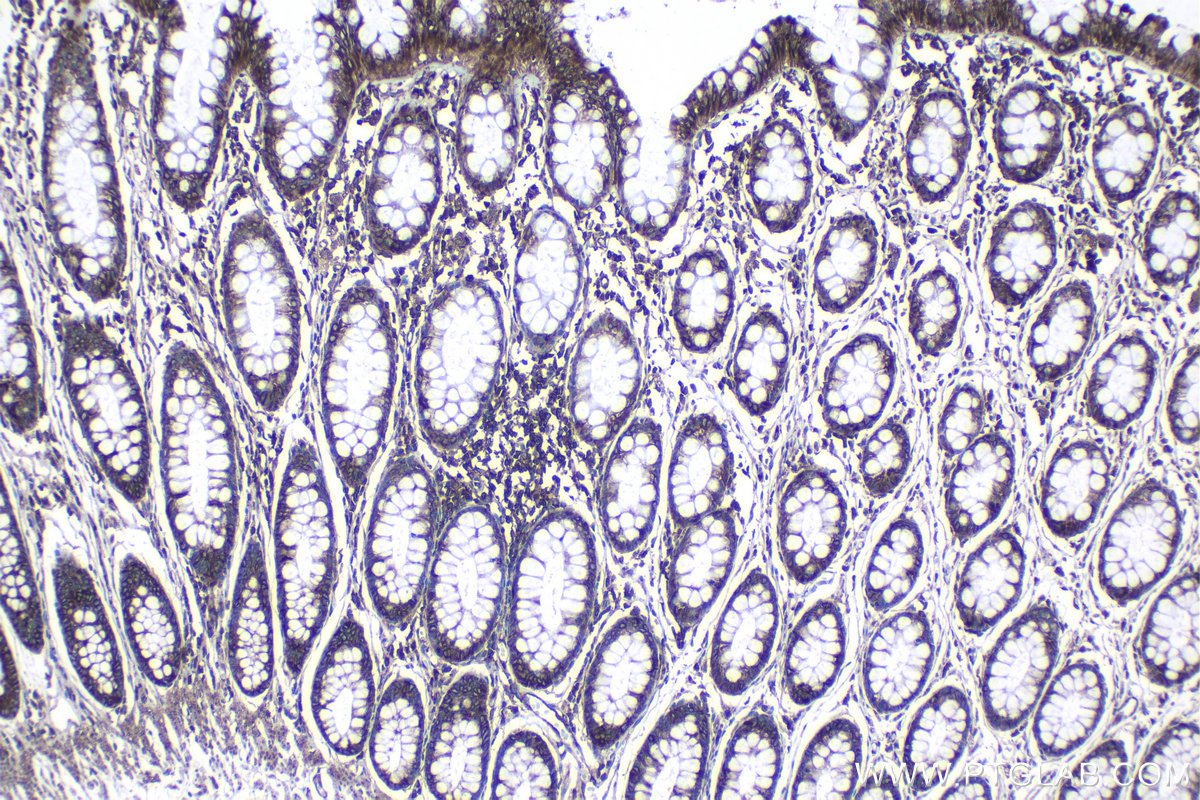 Immunohistochemical analysis of paraffin-embedded human colon tissue slide using KHC1145 (RPLP0 IHC Kit).