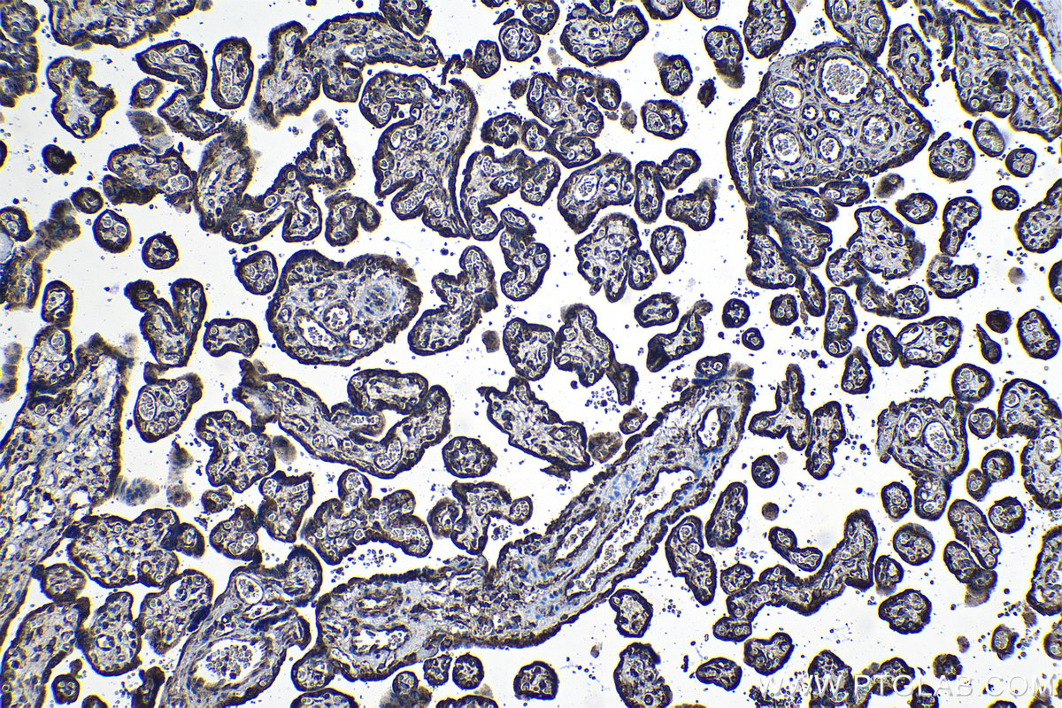 Immunohistochemical analysis of paraffin-embedded human placenta tissue slide using KHC1145 (RPLP0 IHC Kit).