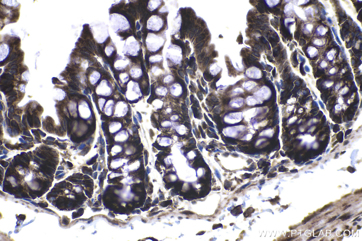 Immunohistochemical analysis of paraffin-embedded mouse colon tissue slide using KHC1145 (RPLP0 IHC Kit).