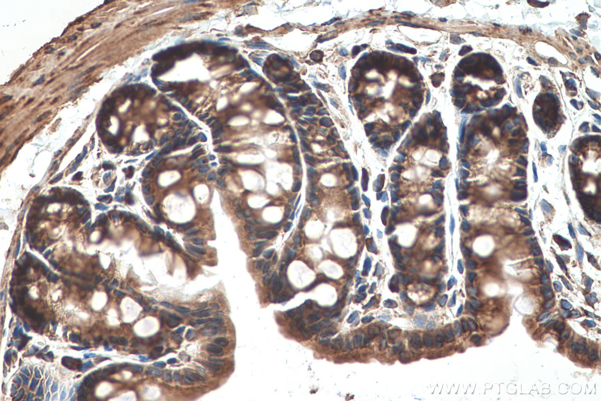 Immunohistochemical analysis of paraffin-embedded mouse colon tissue slide using KHC0831 (RPLP1 IHC Kit).