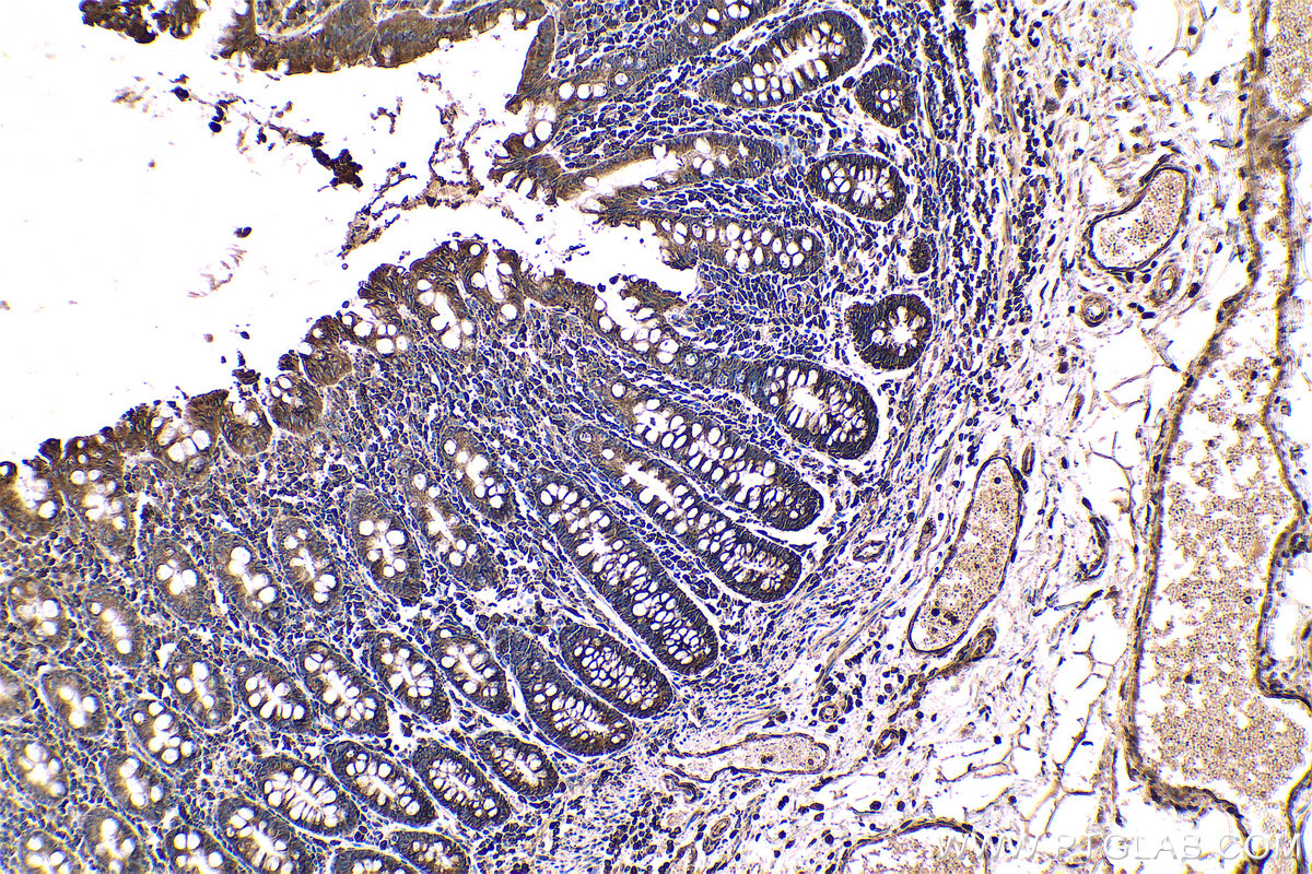 Immunohistochemical analysis of paraffin-embedded human colon tissue slide using KHC0576 (RPLP2 IHC Kit).