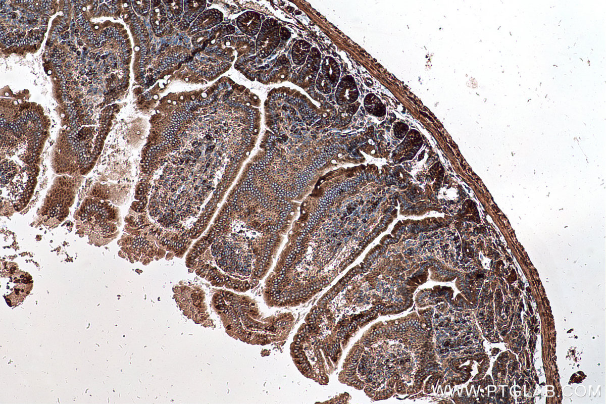 Immunohistochemical analysis of paraffin-embedded mouse small intestine tissue slide using KHC0576 (RPLP2 IHC Kit).