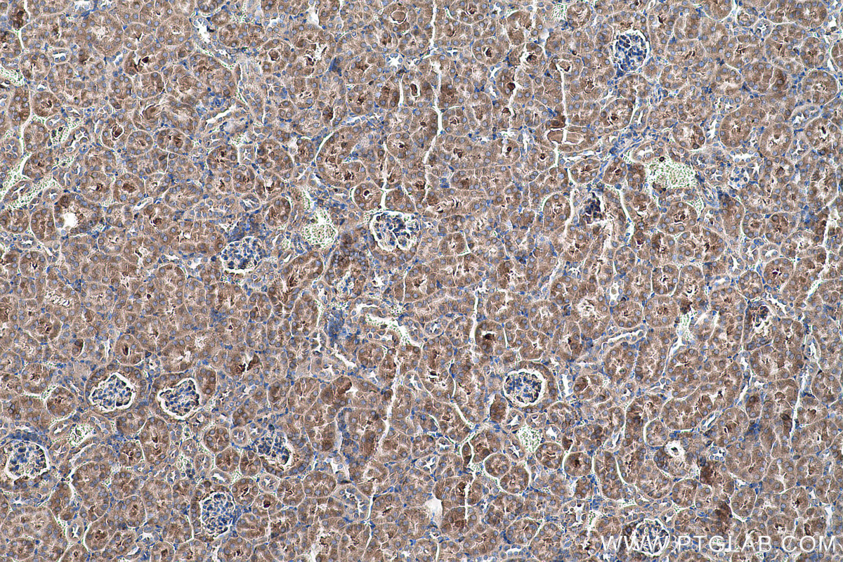 Immunohistochemical analysis of paraffin-embedded mouse kidney tissue slide using KHC0576 (RPLP2 IHC Kit).