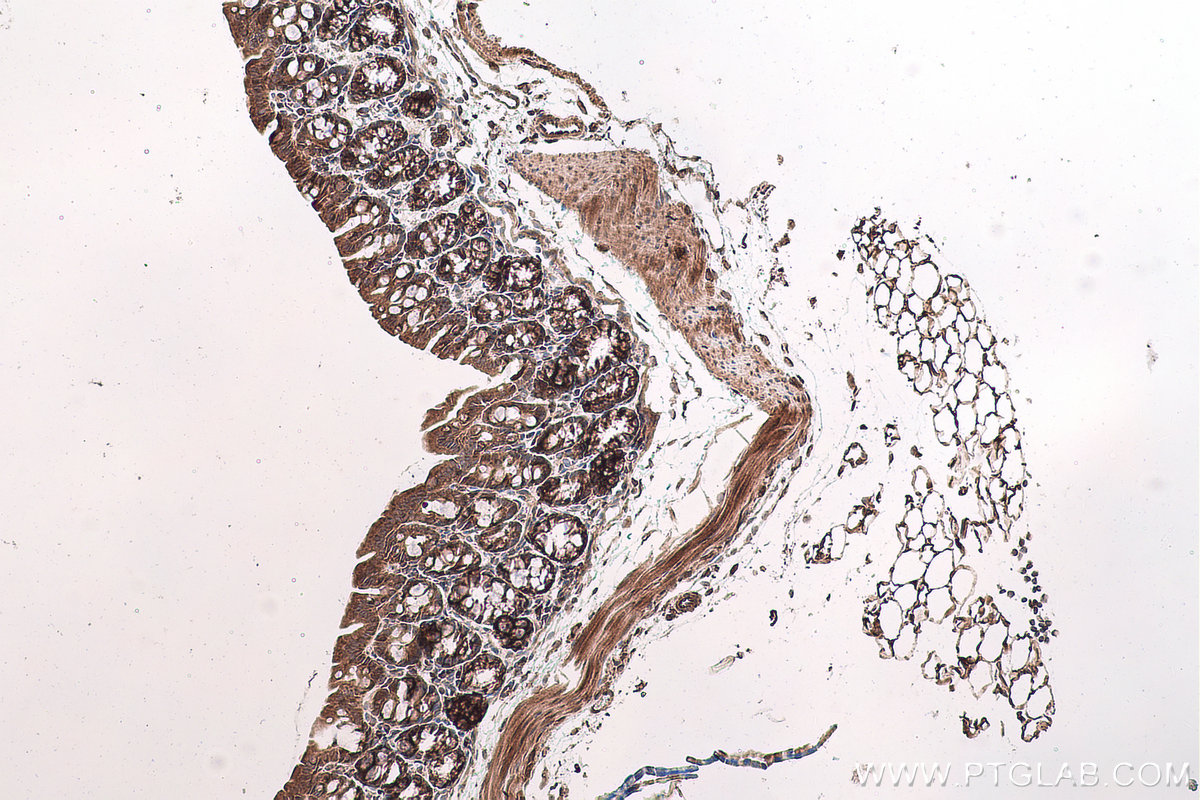 Immunohistochemical analysis of paraffin-embedded mouse colon tissue slide using KHC0711 (RPN2 IHC Kit).