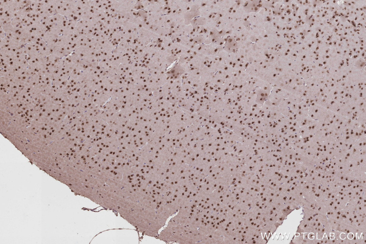 Immunohistochemical analysis of paraffin-embedded rat brain tissue slide using KHC2812 (RPRD1A/P15RS IHC Kit).