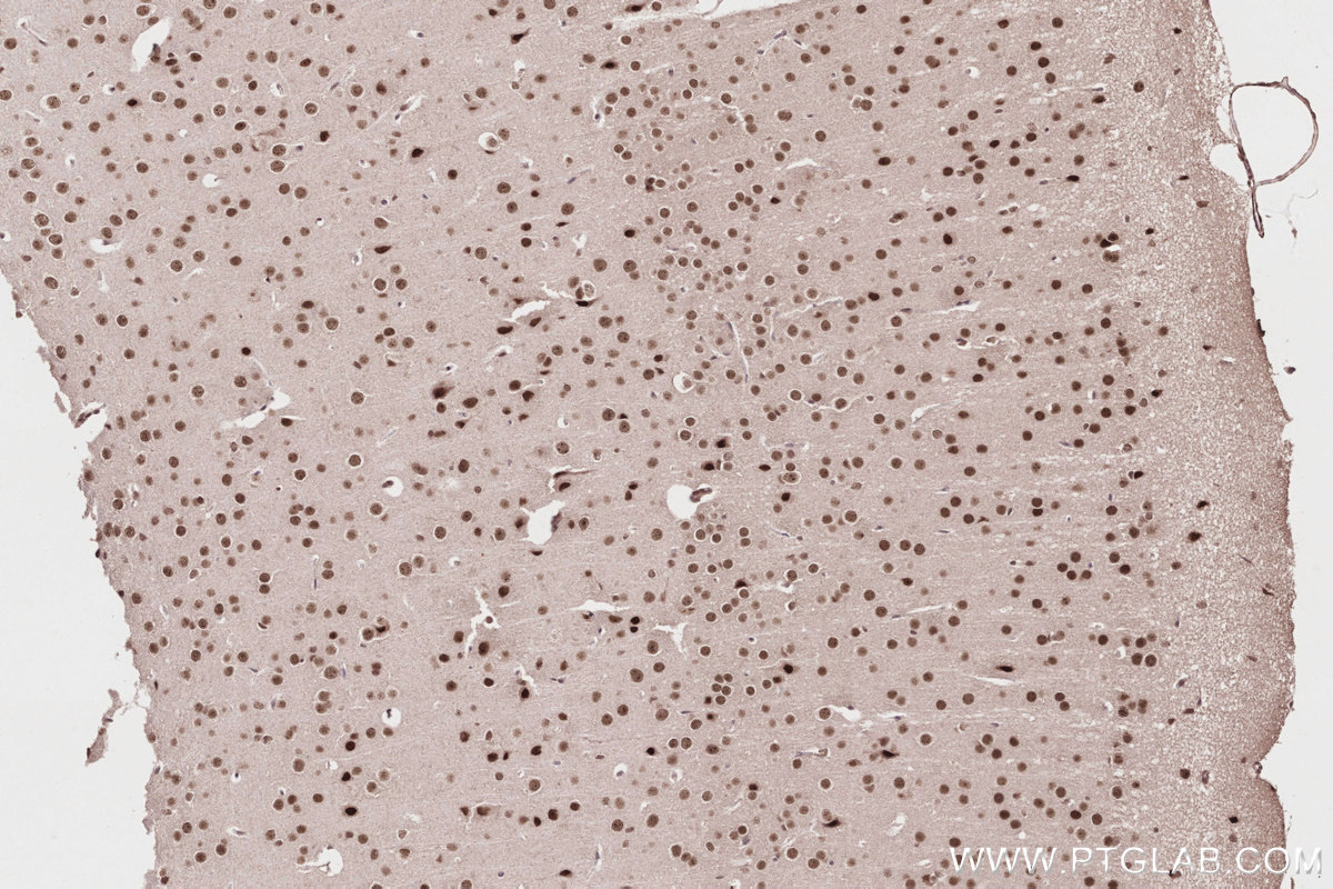 Immunohistochemical analysis of paraffin-embedded mouse brain tissue slide using KHC2812 (RPRD1A/P15RS IHC Kit).