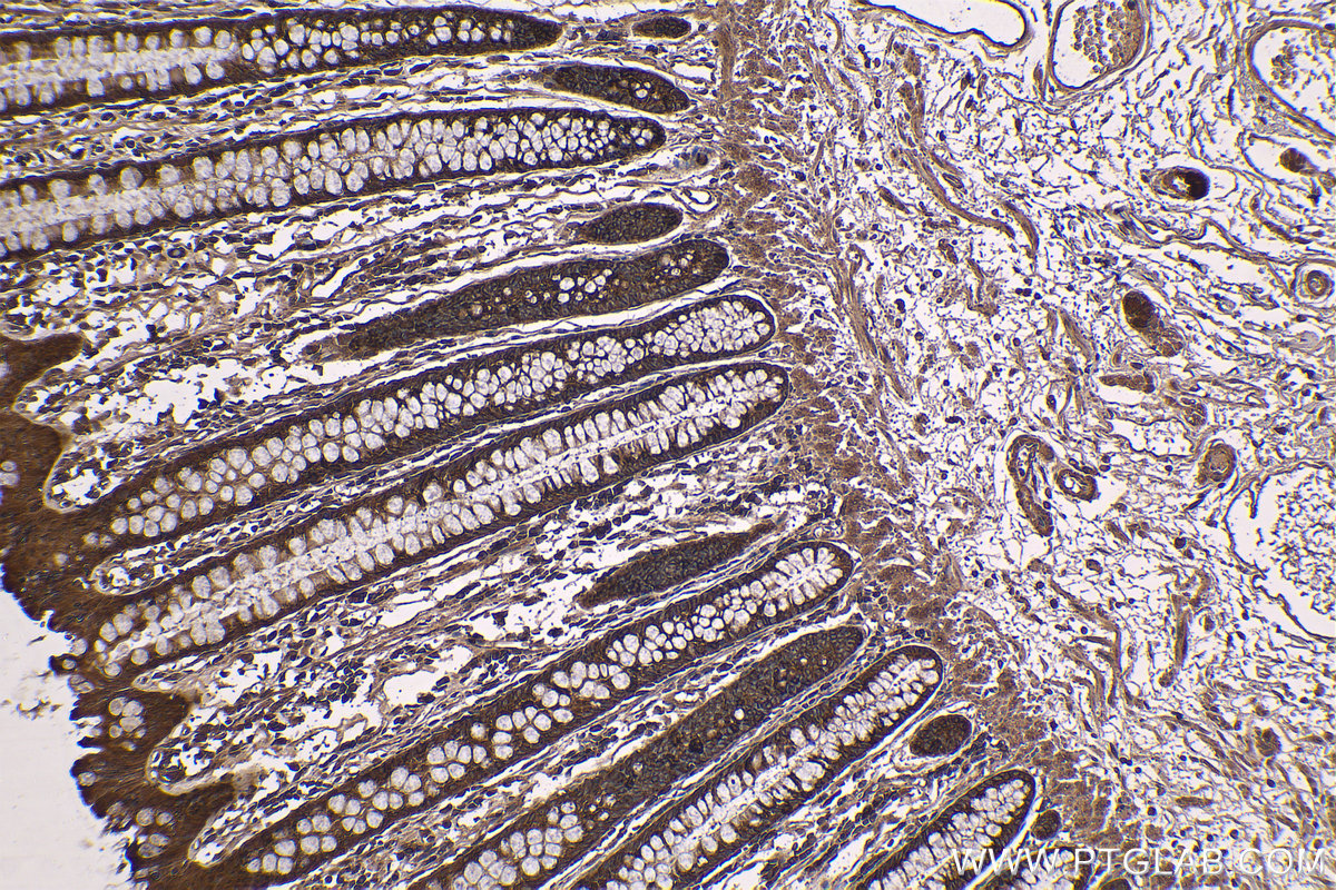 Immunohistochemical analysis of paraffin-embedded human colon tissue slide using KHC1188 (RPS20 IHC Kit).