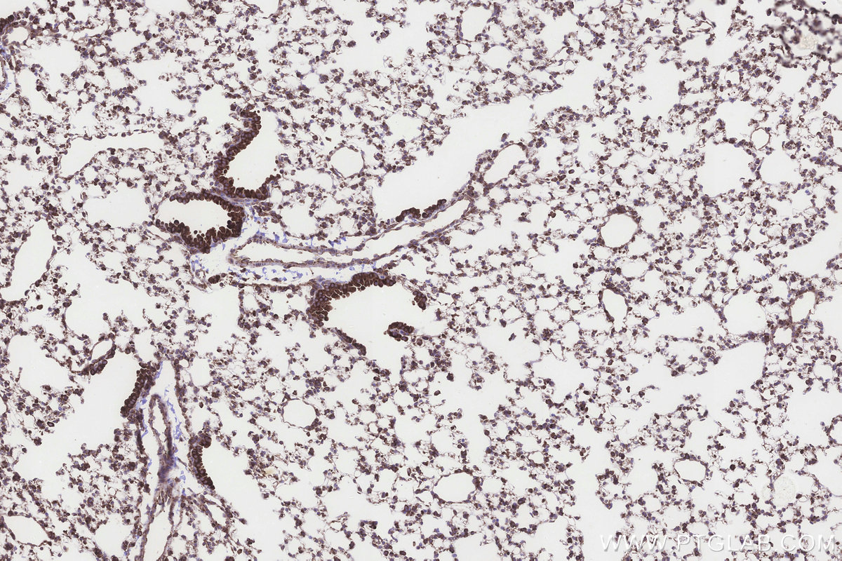 Immunohistochemical analysis of paraffin-embedded mouse lung tissue slide using KHC3243 (RPS23 IHC Kit). Immunohistochemical analysis of paraffin-embedded mouse lung tissue slide using KHC3243 (RPS23 IHC Kit).