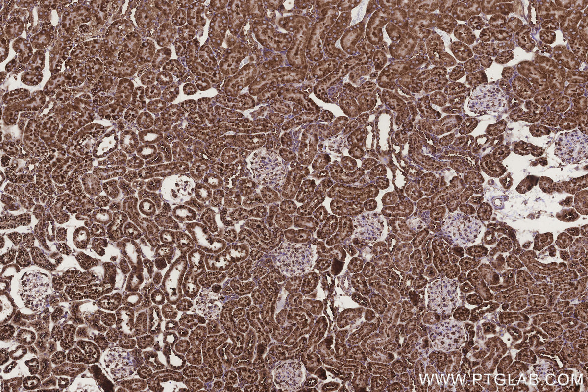 Immunohistochemical analysis of paraffin-embedded rat kidney tissue slide using KHC3243 (RPS23 IHC Kit). Immunohistochemical analysis of paraffin-embedded rat kidney tissue slide using KHC3243 (RPS23 IHC Kit).