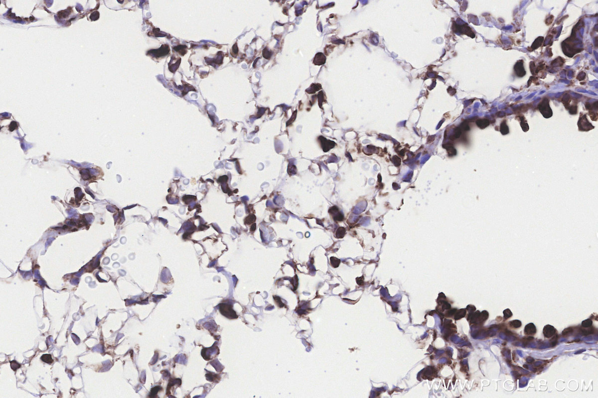 Immunohistochemical analysis of paraffin-embedded rat lung tissue slide using KHC3243 (RPS23 IHC Kit). Immunohistochemical analysis of paraffin-embedded rat lung tissue slide using KHC3243 (RPS23 IHC Kit).