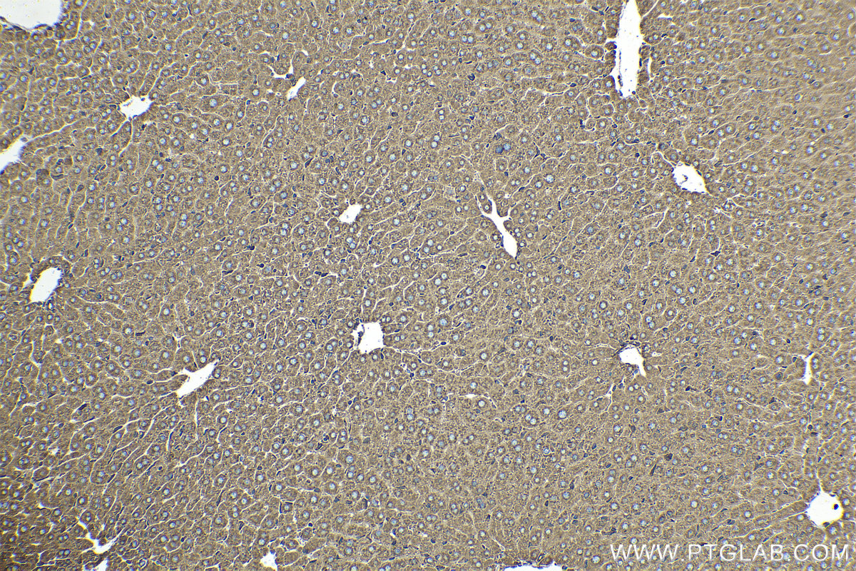 Immunohistochemical analysis of paraffin-embedded mouse liver tissue slide using KHC1560 (RPS3 IHC Kit).