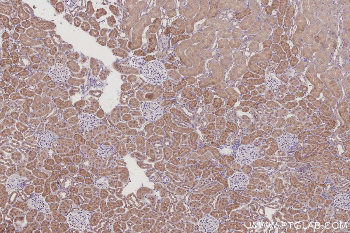 Immunohistochemical analysis of paraffin-embedded rat kidney tissue slide using KHC3001 (RPS6KB2 IHC Kit). Immunohistochemical analysis of paraffin-embedded rat kidney tissue slide using KHC3001 (RPS6KB2 IHC Kit).